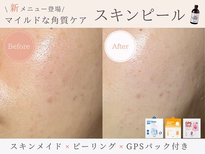 ヴェリス 福岡店(Velisse)の写真