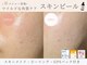 ヴェリス 福岡店(Velisse)の写真