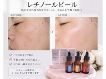 カラン(CALIN)