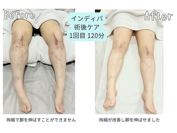 カリド ラボ(CALIDO LAB)の写真/《術後ケア◎》美容施術後などのダウンタイムで気になる痣・むくみやこう縮に特化し深部まで届く最新機ケア