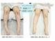 カリド ラボ(CALIDO LAB)の写真/《術後ケア◎》美容施術後などのダウンタイムで気になる痣・むくみやこう縮に特化し深部まで届く最新機ケア