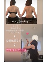 ジーニー(Genie)/ハイパーナイフ