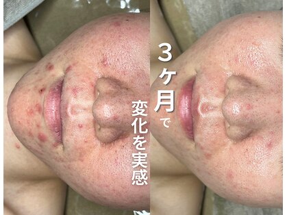 ソアスキン(SOAskin)の写真
