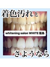 ホワイトニングサロン ホワイト(WHITE)/着色汚れとさようなら