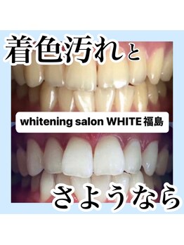 ホワイトニングサロン ホワイト(WHITE)/着色汚れとさようなら