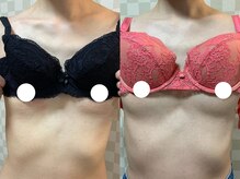 ハレオラ(HaleOla)/お客様の変化☆バストケア