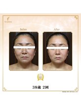 ビモア(美more)/お客様３ フェイシャル