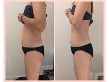 ワイズ(Y's)/お腹8回目