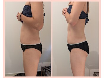 ワイズ(Y's)/お腹8回目