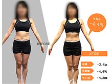 ジーサルース(Gサルース)/W様（３０代）【２カ月】　前