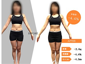 ジーサルース(Gサルース)/W様（３０代）【２カ月】　前