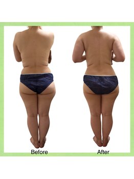 ウェルース(Velus)/1回でこの変化!