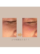 ナナイロ(nanairo)/気になる目のシワもつるつる