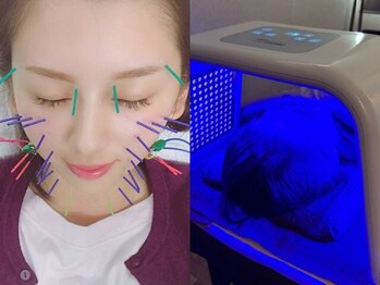 みずわき治療院の写真/【低価格×高技術◇】痩身や美肌の人気機器を導入！その日のお肌の状態やあなたのお悩みに合わせてご選択◎