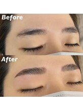 キンキー 広島(kinky)/