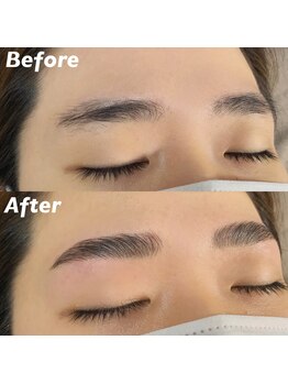 キンキー 広島(kinky)/