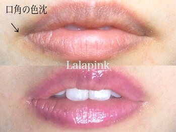 カルム(Calme)/Lalapink