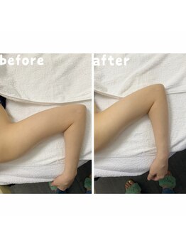 エクスクラメーションマーク(!!!)/★二の腕★