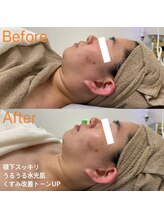 ラ フルール(La Fleur)/エアバリ