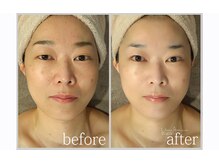 アン グレーヌ 自由が丘(unegraine)/まぶたクッキリ！持ち上がる