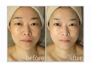 アン グレーヌ 自由が丘(unegraine)/まぶたクッキリ！持ち上がる