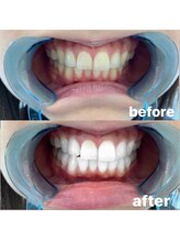 ライトビューティー 池袋店(LightBeauty)/症例写真