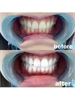 ライトビューティー 池袋店(LightBeauty)/症例写真