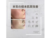 エミナル(EMINAL)