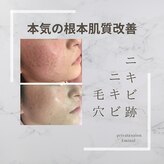 エミナル(EMINAL)