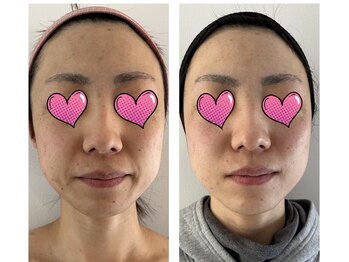 クラ接骨院(KURA接骨院)/細胞から美しく