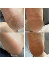 かかとふわふわ★角質ケア