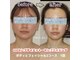 ボディグロス 梅田店(BODY GLOSS)の写真