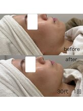 グラシア(gracia)/レモンボトル