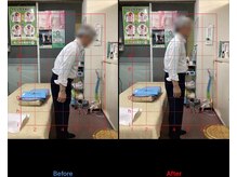 高芝鍼灸整骨院/痛くて伸びない腰の痛み