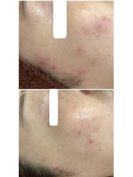 ロゼブランシュ(Rose Blanche)/