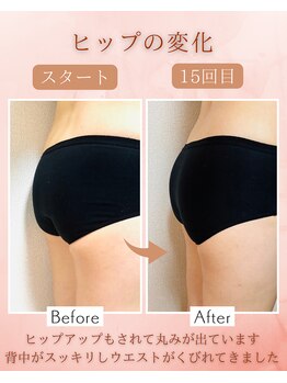 ラジュワード(lajward)/骨盤底筋トレーニング