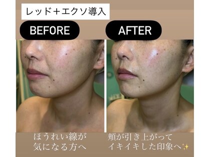 アカツキファイブ(AKATSUKI5)の写真