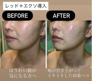 アカツキファイブ(AKATSUKI5)