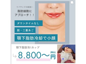 シャルム(CHARME)/顎下脂肪冷却