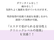 スキンラボ ドットシキブ 厚木海老名店(skinlabo .sikibu)/温熱で気持ちよく受けられます。