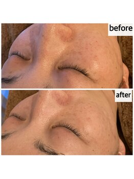 メナードフェイシャルサロン 岐阜茜部/ホワイトニング/紫外線/透明感