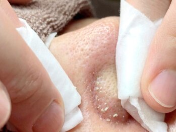 エレヌイ(ELENUI)/結果重視★毛穴改善