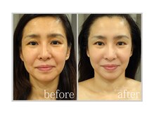 アン グレーヌ 自由が丘(unegraine)/表情筋がほぐれ笑顔も美しく♪