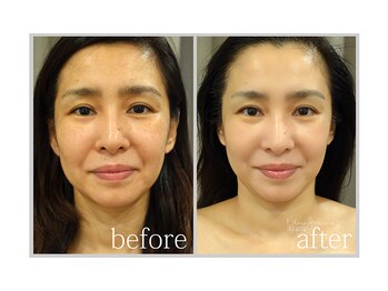 アン グレーヌ 自由が丘(unegraine)/表情筋がほぐれ笑顔も美しく♪