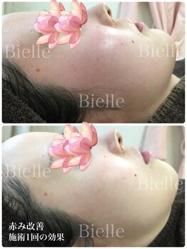 ビエル(Bielle)/敏感肌・肌荒れ赤みがある方も