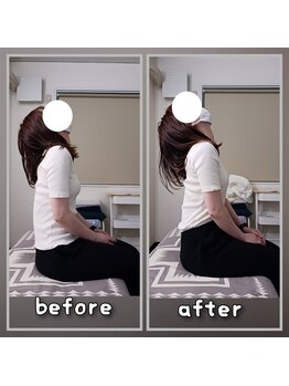 ぷめはな整体/首肩の動きの変化♪