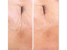 ジーニー(Genie)/ララピール　始まってますよ！