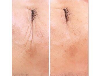 ジーニー(Genie)/ララピール　始まってますよ！