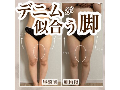 ミュウ(miuex)の写真