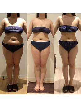 アユアランリンク 札幌店/G : 4ヵ月半で-20kg！